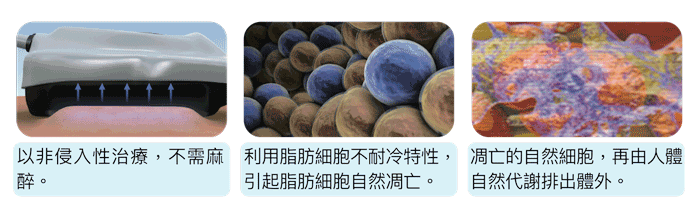 冷凍減脂原理 冷凍減脂效果