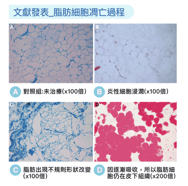 冷凍減脂原理 冷凍減脂效果